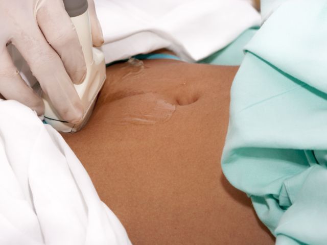 Hematoamele periovulare în sarcinile de trimestrul I…cât de mult să ne îngrijorăm?