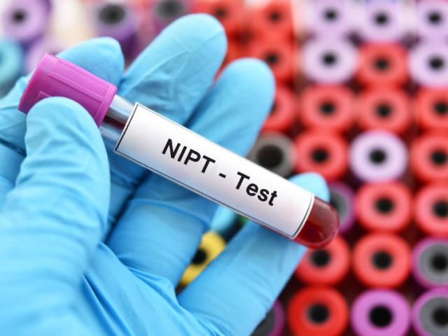 Testarea prenatală noninvazivă (NIPT)